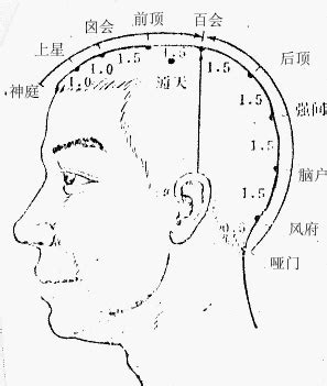 腦門穴|醫砭 » 經穴庫 » 腦戶